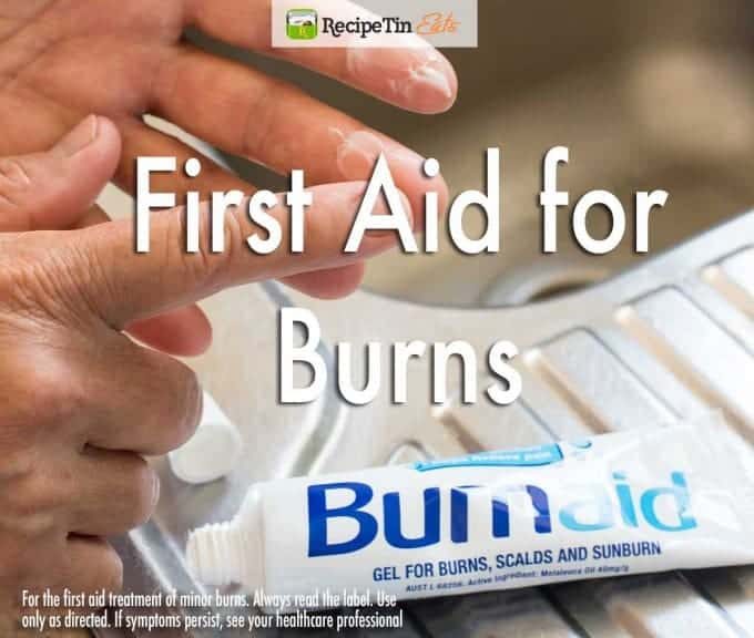 First-Aid-for-Burns_v2